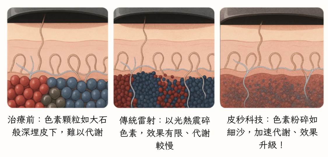 皮秒雷射作用原理圖示