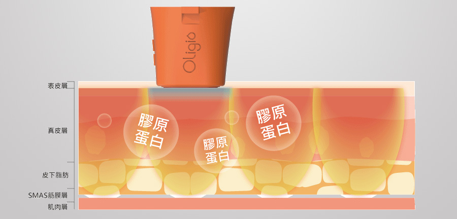 Oligio X超玩美電波由外而內 緊緻除皺