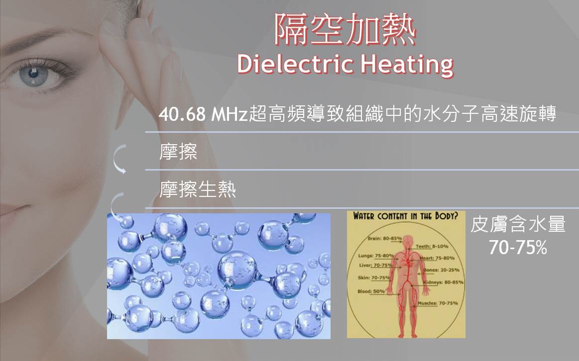 Alma電波拉提原理示意圖