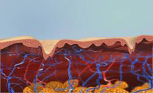 Alma電波拉提案例1