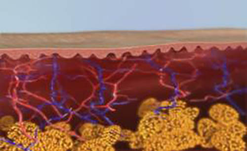 Alma電波拉提案例3