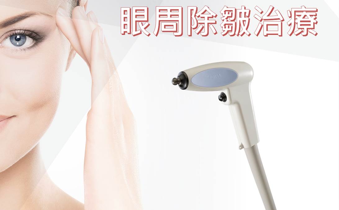 Alma電波拉提治療示意圖