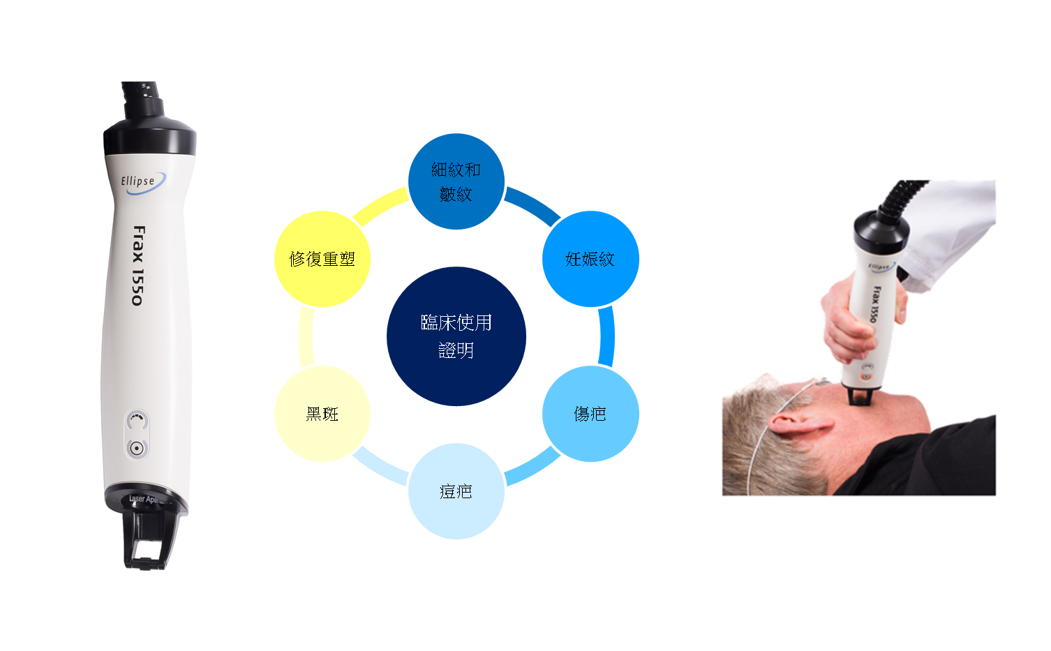 Nordlys魔幻極光飛梭適應症圖片