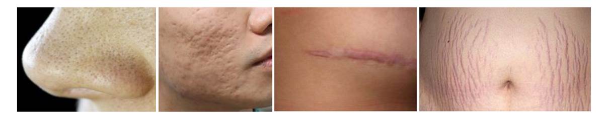 Nordlys魔幻極光飛梭療程前注意事項圖示