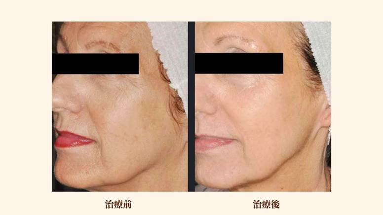 Nordlys魔幻極光飛梭案例照片