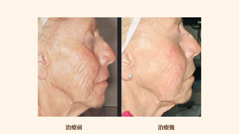 Nordlys魔幻極光飛梭案例照片