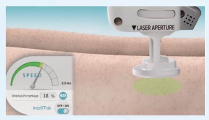 即時溫感監控兼具療效與安全性